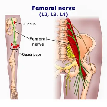 Will Inversion Table Help With Femoral Nerve Pain