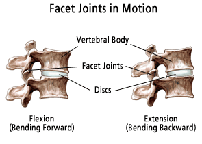 Is An Inversion Table Good For Facet Joint Syndrome