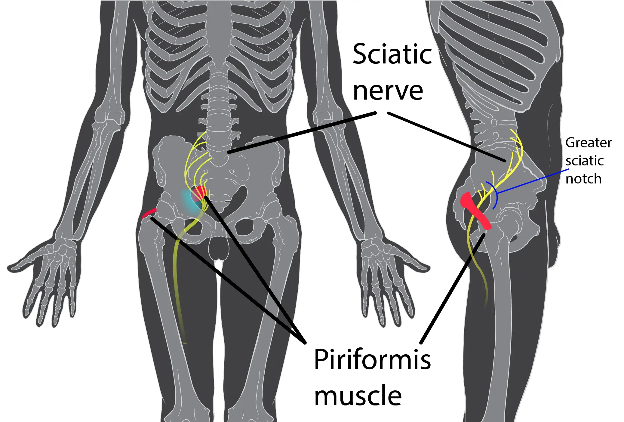 Will An Inversion Table Help Piriformis Syndrome