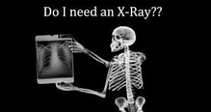 Back X-Ray