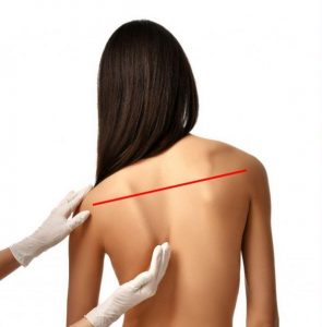 Can A Chiropractor Fix Uneven Shoulders