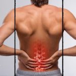 Can A Chiropractor Help With Nerve Pain
