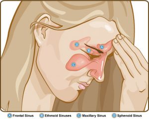 Can A Chiropractor Help With Sinus Issues