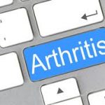 Can A Chiropractor Tell If You Have Arthritis