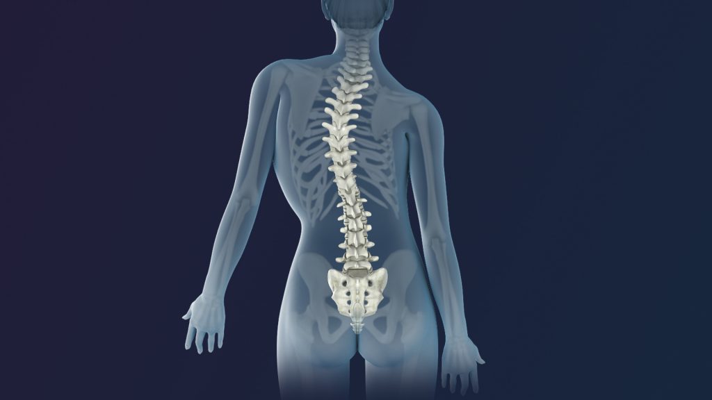 Can Chiropractors Help With Scoliosis