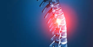 Can Scoliosis Cause Herniated Disc